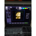 Scanner de ultrassom DW-C60 para laptop 3d 4d